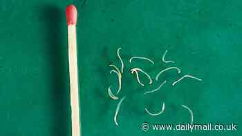 Could YOU have worms and not know it? Gut symptom that affects millions could be hidden sign of parasites, here's how to tell