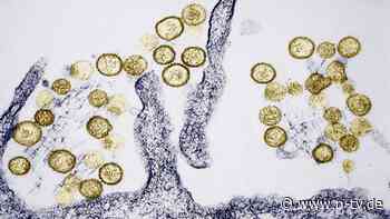 Was ist das Hantavirus?: An diesem tückischen Erreger starb Gene Hackmans Frau