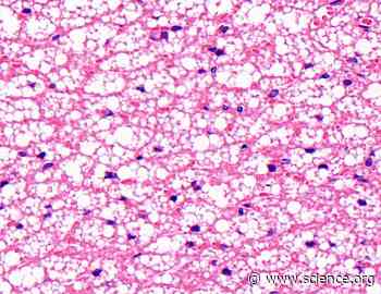 Myeloid sirtuin 6 deficiency causes obesity in mice by inducing norepinephrine degradation to limit thermogenic tissue function | Science Signaling