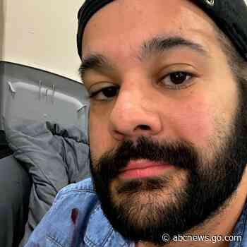 WATCH:  Partially blind artist overcomes vision loss to create stunning paintings