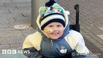 Appeal to buy artificial legs for four-year-old