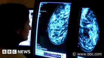 Breast screening rate 'unacceptable', meeting told
