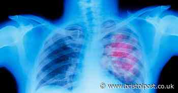 Lung cancer risk linked to surprising lifestyle choice - it goes beyond just smoking