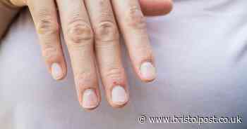 Dermatologist shares one sign on your fingernails you should never ignore
