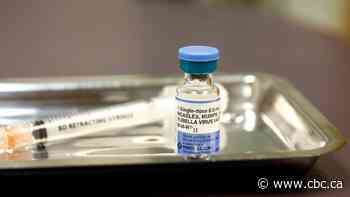 Potential measles exposure alert issued after case confirmed in Calgary