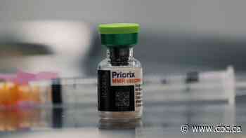 Measles cases confirmed in Edmonton, triggering public health warning 