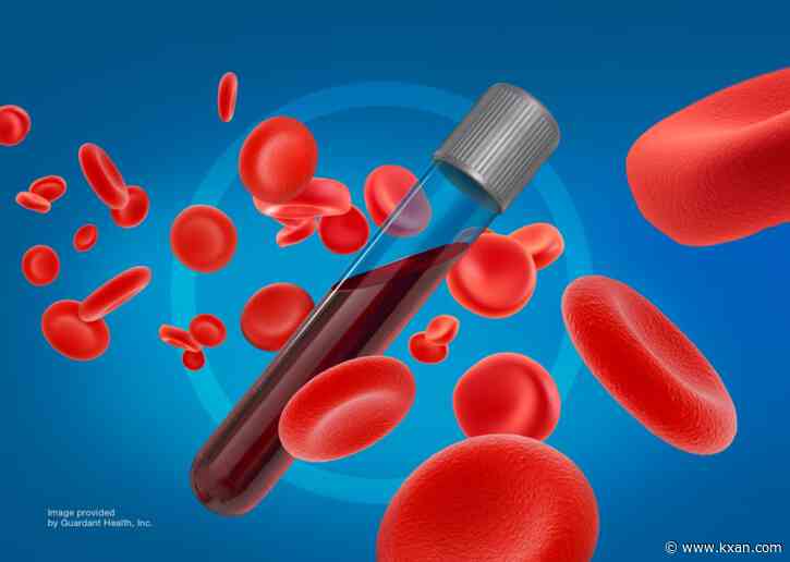 LIVE: New blood test for colon cancer offers less invasive option, hopes to increase early detection