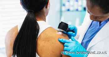 Dermatologist warns of signs of skin cancer that can appear on your body