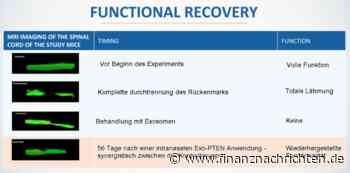 NurExone Biologic: Zacks Research sieht fast 600% Potential!