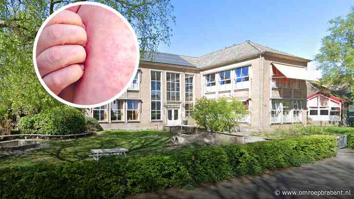 Nu ook mazelenbesmettingen buiten basisschool, aantal gevallen gestegen