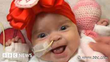 Baby with rare blood disorder finds stem cell donor