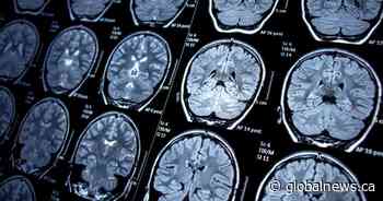 N.B. mystery illness: Health minister says he ‘forgot’ he sent letter dismissing neurologist