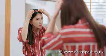 'I'm a dermatologist – patchy grey hairs could be sign of common issue'