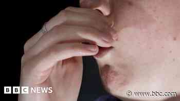 Surge in repeat lung condition hospital visits