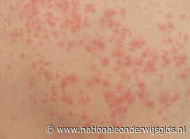 Basisschool in Almere gesloten vanwege mazelenuitbraak