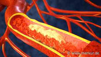 Nicht nur das Herz – schwankendes Cholesterin kann diese wichtige Funktion im Körper beeinträchtigen
