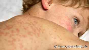 Masern auf dem Vormarsch – warum das so gefährlich ist