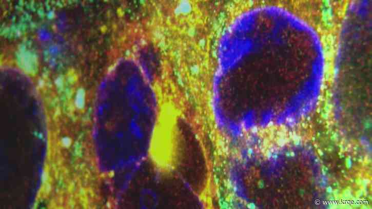 Herpes' connection to cancer: What doctors are learning from the virus