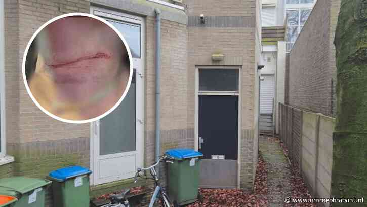 Vrouw om niets ernstig mishandeld: 'Zoveel geweld moet opgevallen zijn'