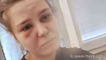 Wegen Stress mit Silvia? Calantha Wollny liegt im Krankenhaus