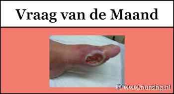 Vermindert de pijn van een arterieel ulcus bij het hoogleggen van het been?