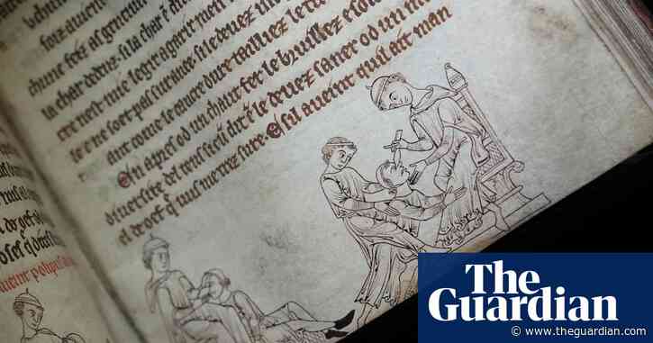 Why the weasel testicles? Cambridge show explains medieval medicine