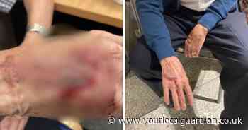 Grandad left 'dripping blood' after Tube ticket barrier slammed shut on him