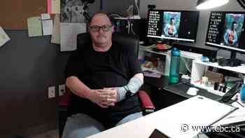 'Would not wish it on my worst enemy,' says Winnipegger sidelined with rare pain syndrome