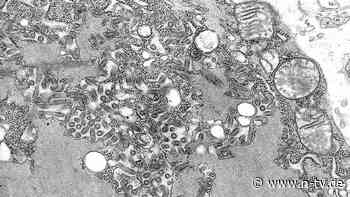 Ungewöhnlicher Fall in Michigan: Patient infiziert sich durch Organtransplantation mit tödlichem Virus