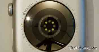 Leaked Apple Watch Series 10 prototype features never-before-seen health sensor