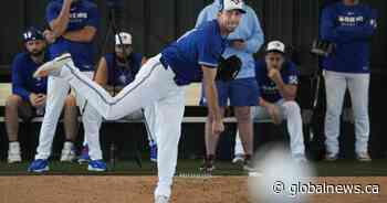 Scherzer day to day after cortisone injection