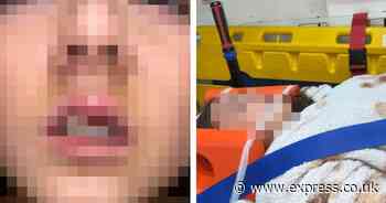 Girl, 13, had 'head kicked like a football' during horror attack on way home from school