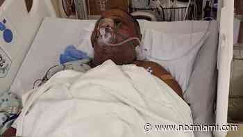 ‘A concussion to his head': Daughter of man beaten at park in Pompano Beach speaks out