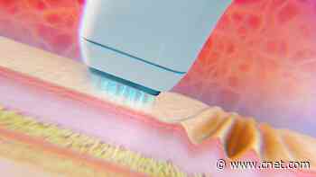 I Tried a Techy Solution for Sagging Skin. Here Are My Honest Thoughts