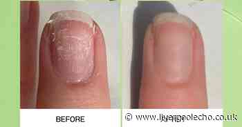 Shoppers say this nail serum saved 'weak, flaky' nails after years of damage