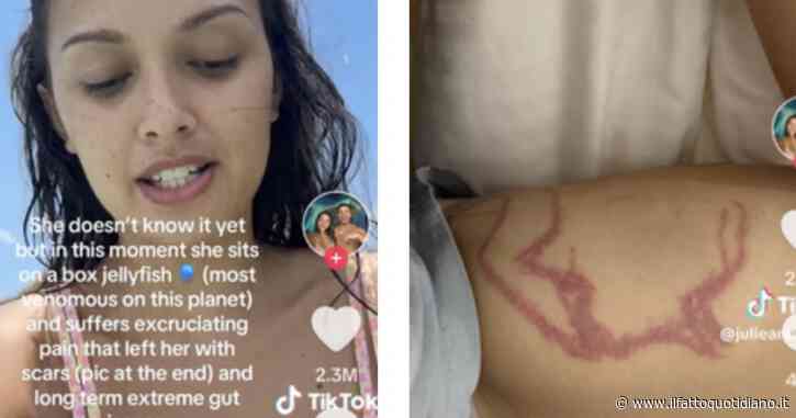 Influencer si fa un video mentre viene punta da uno degli animali più velenosi al mondo, la medusa scatola: “Rischiavo un attacco cardiaco nel giro di mezz’ora”