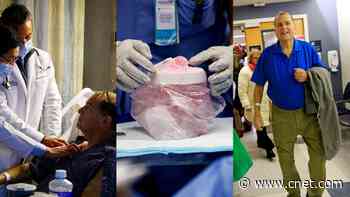 Xenotransplants: Human Receives Gene-edited Pig Kidney video