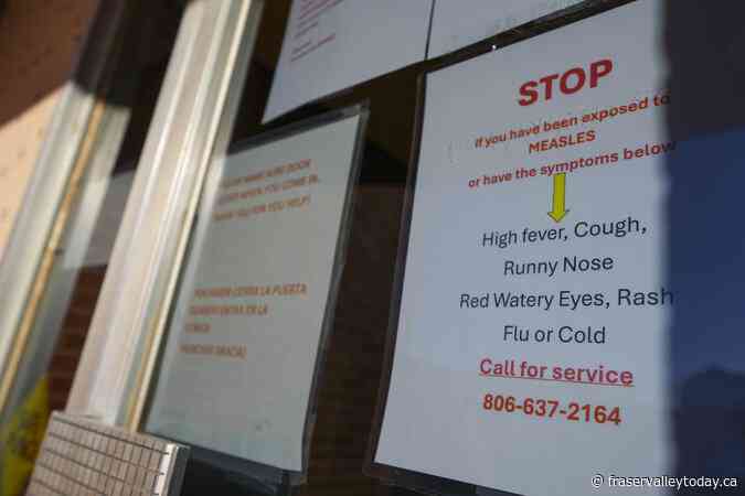 Second child died from measles-related causes in West Texas, where cases are nearing 500