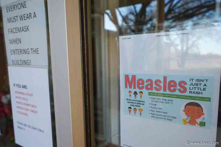 Second child dies from measles in Texas, reports say