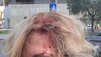 Non solo auto danneggiate. A Tiburtina donna colpita da un sasso lanciato da un 37enne