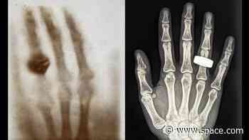 SpaceX's Fram2 mission captures 1st human X-ray in Earth orbit