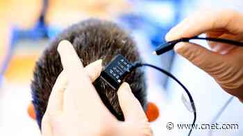 AI Tools Helped Restore Speech for a Woman With Paralysis: 'She Felt Embodied'