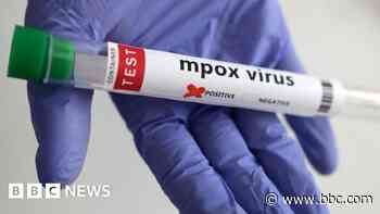 Mpox case confirmed with no travel links