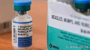 Alberta's measles case counts climb with central zone hardest hit