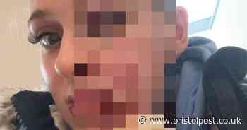 'My face was left looking like a Halloween mask after 62stone cow jumped on my head'