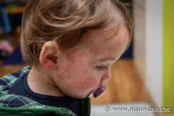Na forse toename in aantal kinderen met mazelen in Antwerpen: wat is de situatie in Gent?