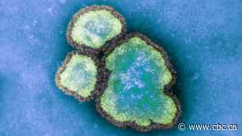 Almost 90 per cent of Ontario's growing measles cases are in the southwest