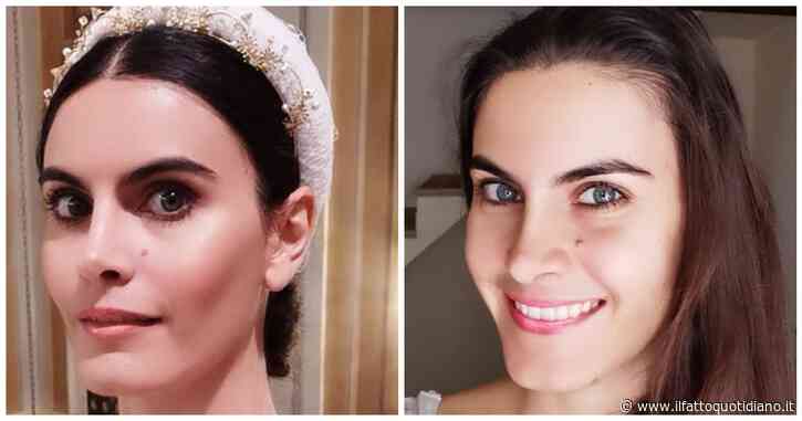 “Ho la malattia delle gambe di legno, ma è sconosciuta all’INPS. Mi impedisce di fare tutto”: la disperazione dell’ex modella Rossella Moretti