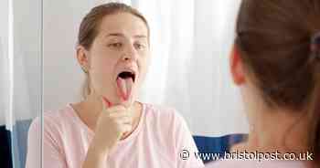 Unusual tongue pattern could be sign of 'dangerous' deficiency