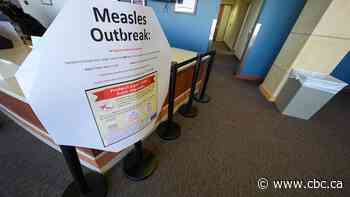 Measles outbreaks spark concern over rare 'horrific' neurological disorder